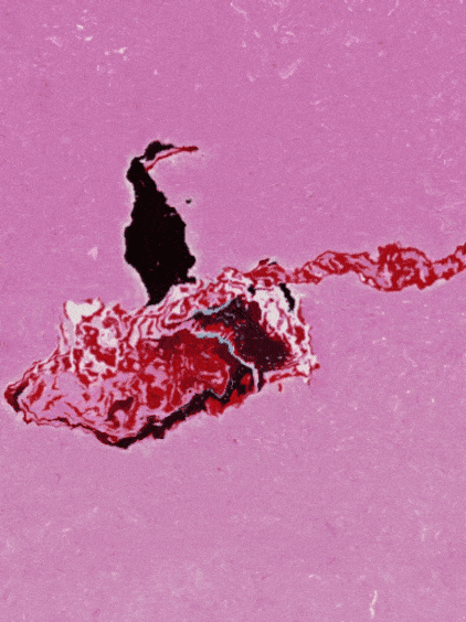 Nft BIRD ON ACID.